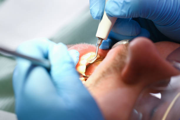 Best After-Hours Emergency Dentist in Mexia, TX