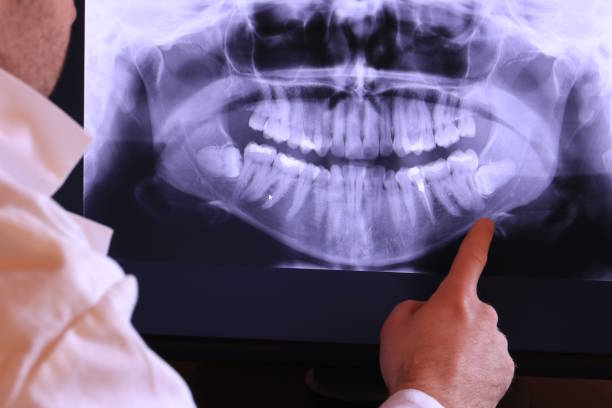 Best Emergency Root Canal Treatment in Mexia, TX