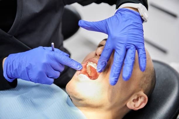 Best Emergency Tooth Extraction in Mexia, TX